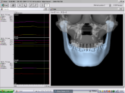 コンピュータによるシミュレーション