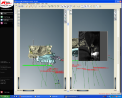 コンピュータによるシミュレーション