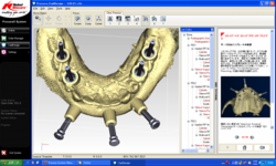 コンピュータによるシミュレーション