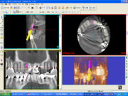 事前シミュレーションで安全なオペが可能