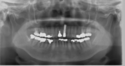 レントゲン画像
